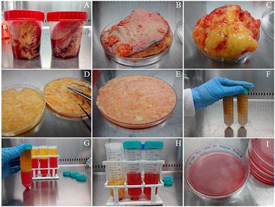 Human Adipose-Derived Mesenchymal Stem/Stromal Cells Handling Protocols. Lipid Droplets and Proteins Double-Staining